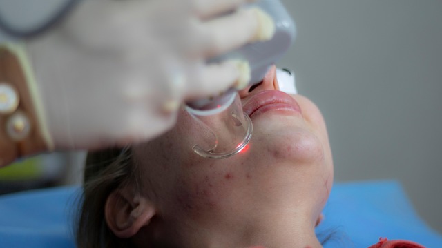 Fakta og myter om laserbehandling – hvad virker egentlig?